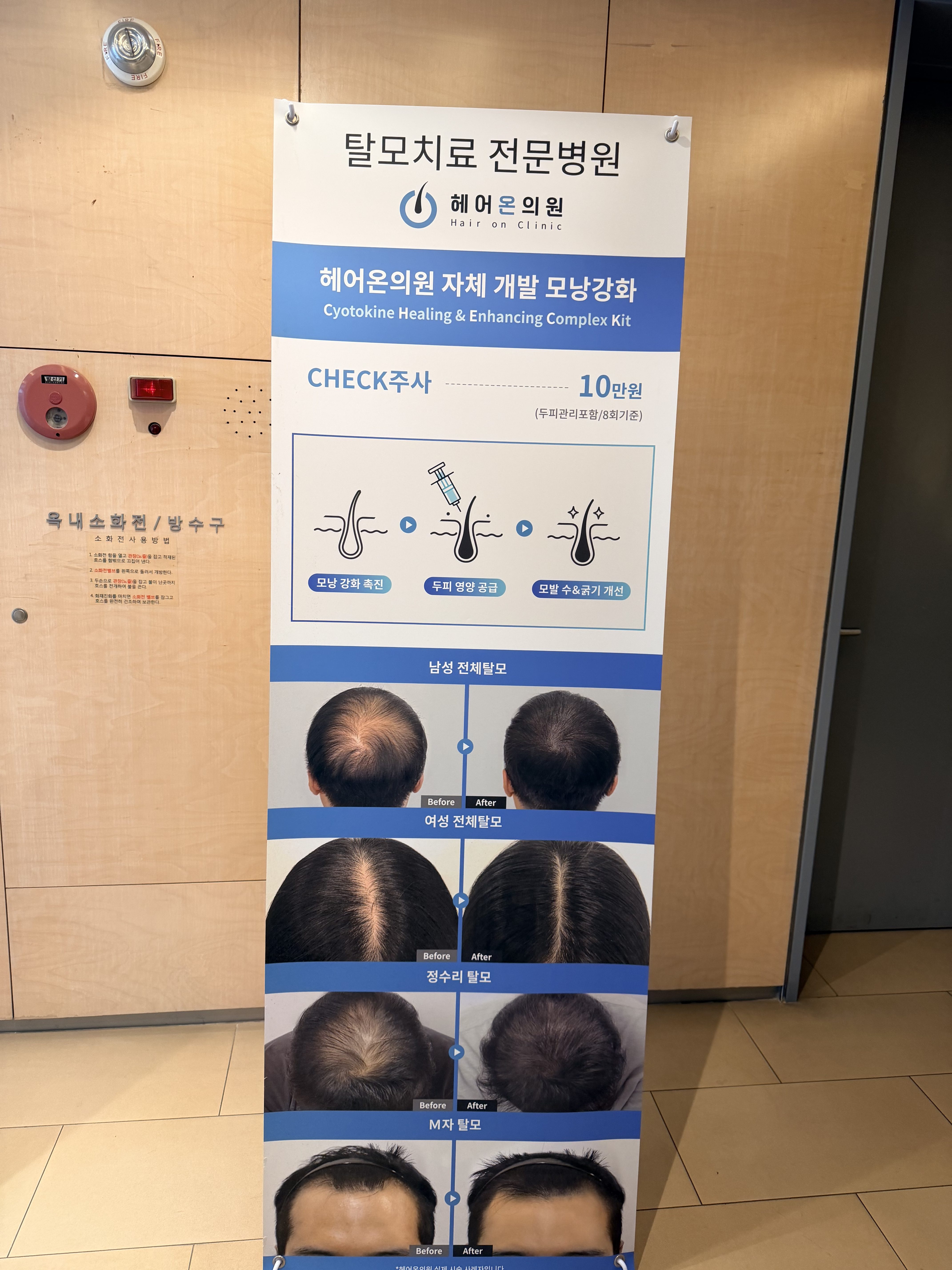 Hair Loss Treatment in Korea: What to Get Based on How Long You’re Staying